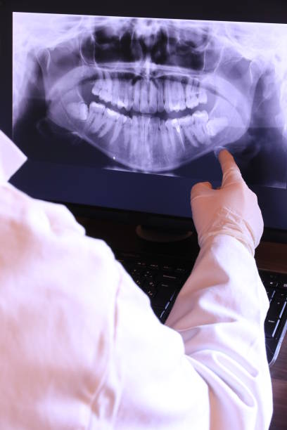 Best Emergency Dental Extractions in Alto, GA