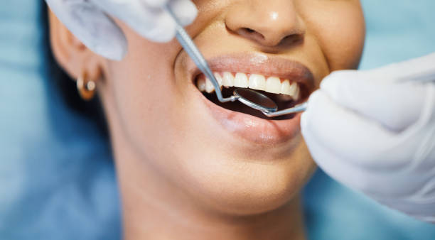 Best Emergency Dentist for Knocked-Out Tooth in Alto, GA